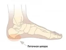 медикаменти медикаменти