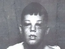 lobotomy малко