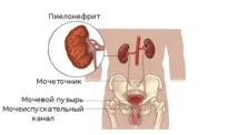 торби торби