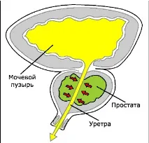 опит лечение