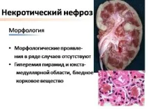 способи