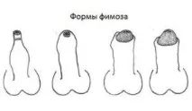 защо появяват