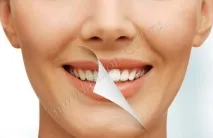 зъбите зъбите