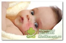 обрив лечение