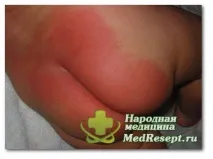 неприятности пелена