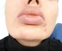 консултации онлайн