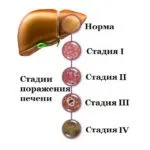 етапи етапи