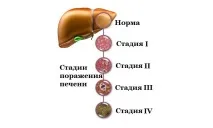 форми етапи
