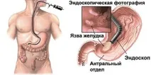 підготовка