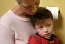Поперечний параліч симптоми, причини, лікування, ознаки поперечний