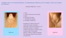 Ознаки вагітності хлопчиком дитини