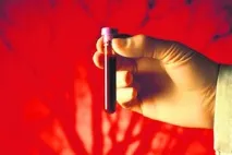 Причини недокрів’я недокрів