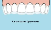 Дитина скрипить зубами уві сні симптоми, причини, що робити у статті Startsmile зубами