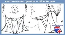 врата нарежете