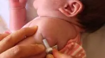 Скільки разів роблять БЦЖ графік та календар щеплень, коли робиться перше щеплення в житті проти графік