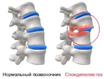 стълб гръбначен