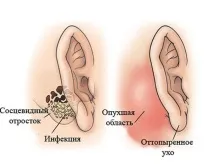 приглухуватість