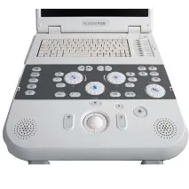 УЗД апарат Siemens Acuson P300 p300