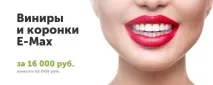 езикови брекети зъбната редица