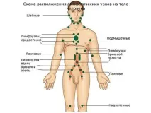 лимфните възпаление
