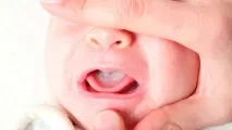 стоматитът стоматитът