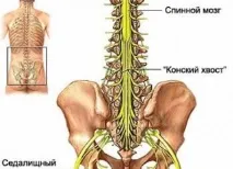 защемлення