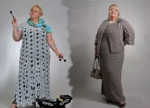 игли ръкави