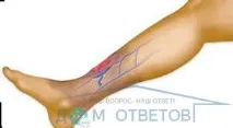 лечение отговори