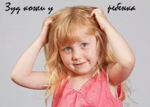 Сверблячка шкіри у дитини, Все про дітей, все для батьків дитини