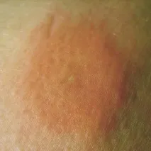 снимки описание
