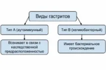 гастриті