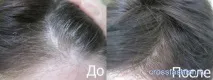 Crossfashion Group - Як зафарбувати сивину на низькому відсотку окислювача crossfashion