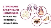 признака дисфункция
