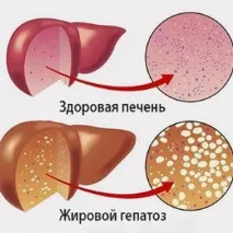 дифузни промени