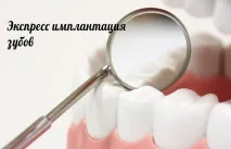 експресна зъбите
