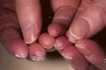 снимка снимка
