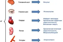 гіпертонія