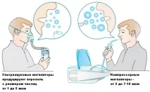 Інгаляції при мокрому та вологому кашлі небулайзером у домашніх умовах вологому
