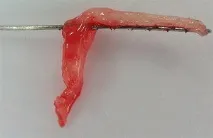 зубний