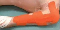 книга кинезиотейпинг