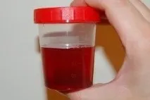 сеча