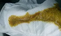 грудничка