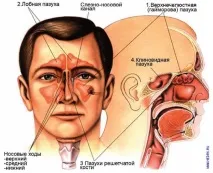 лечение параназалните синуси