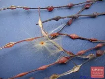 Възможни трудности Mandevilla boliviensis