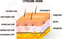 симптоми меланом