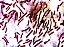 Bacillus anthracis антракс серум