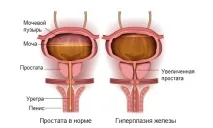 нюансите нюансите