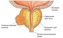 нюансите изследването