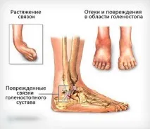 причини причини