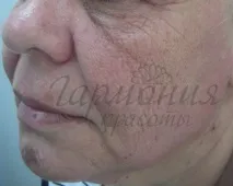 меките тъкани меките тъкани